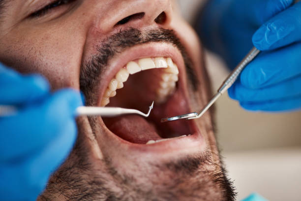  Randolph Af, TX Emergency Dentist Pros